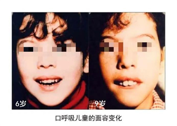 图片 2.jpg 图片 2.jpg